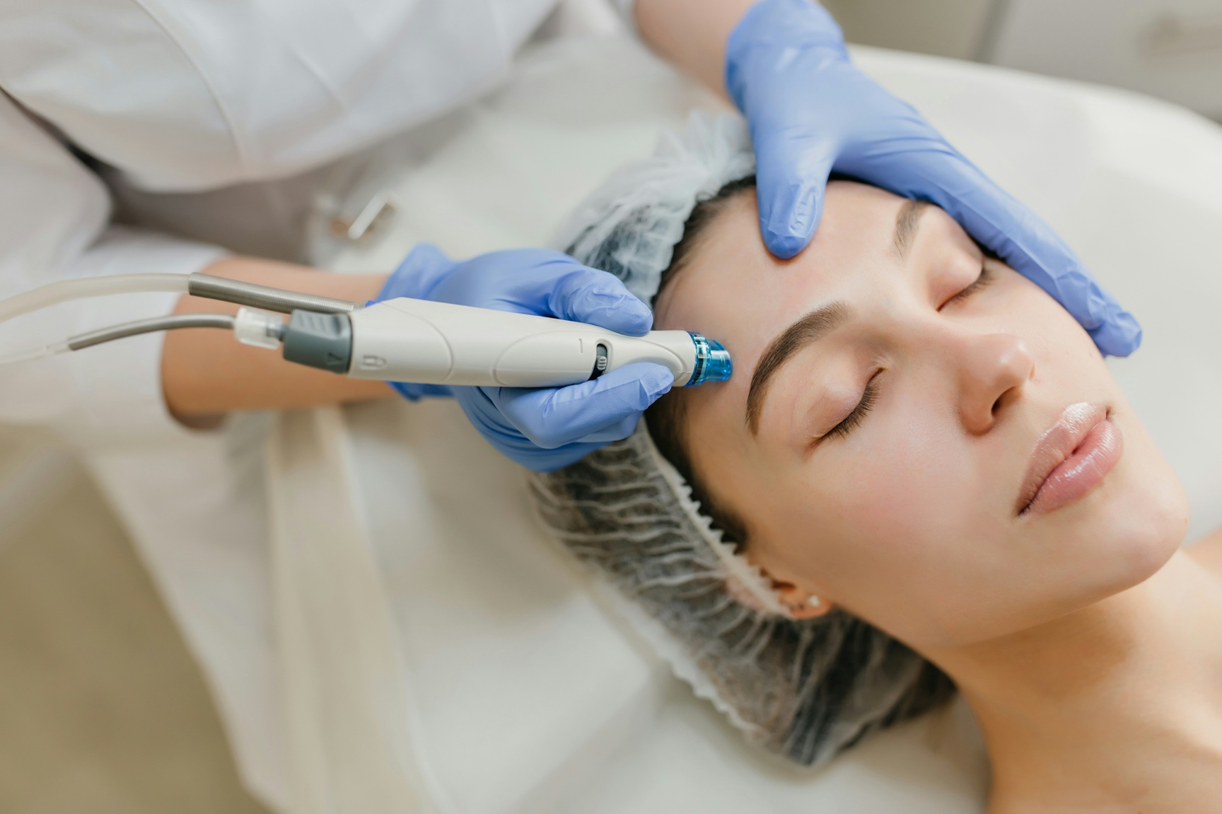 Laser Treatment